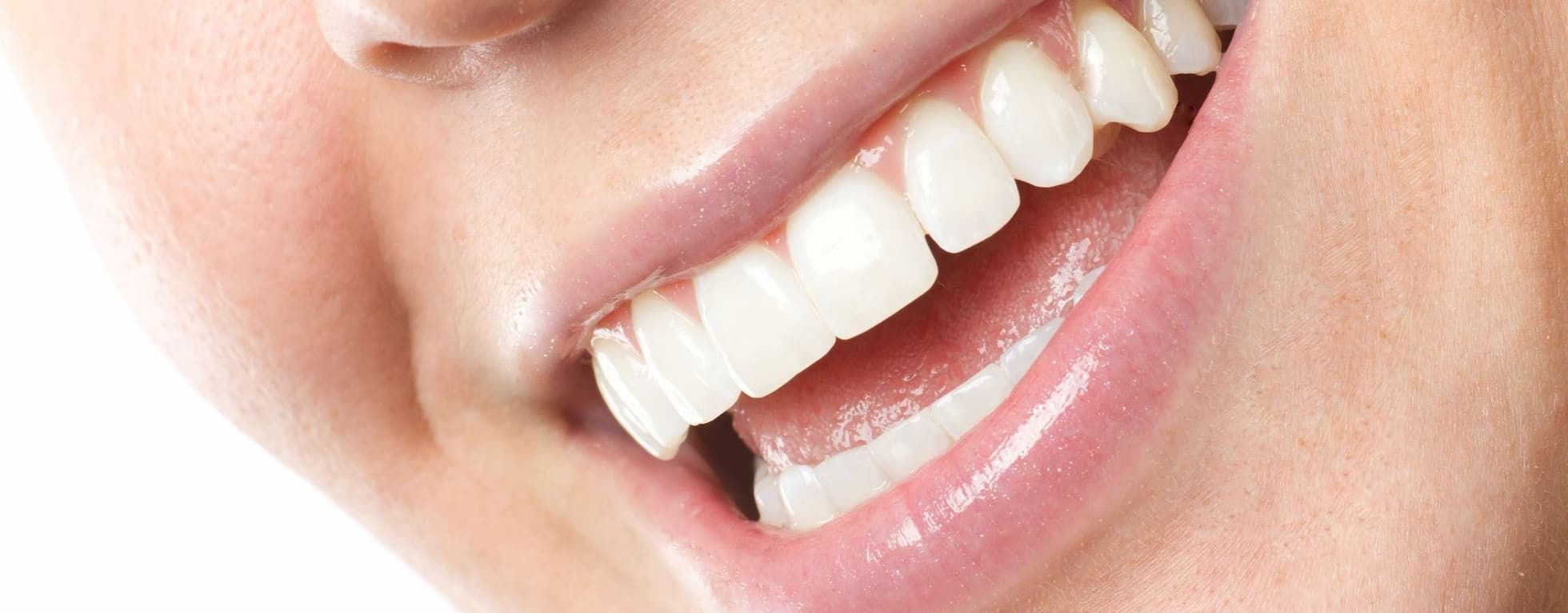 Lächelnde Frau zeigt ihre geraden Zähne