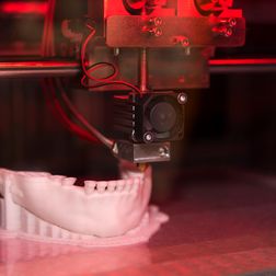 Herstellung digitalisierter Kiefermodelle mittels 3D-Drucker