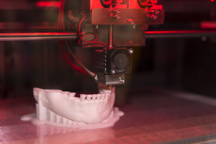 Herstellung digitalisierter Kiefermodelle mittels 3D-Drucker